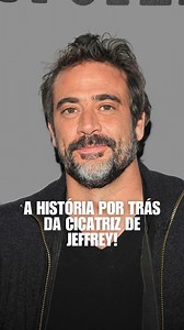 Em uma antiga entrevista no The View, Jeffrey Dean Morgan contou como ganhou a cicatriz em seu rosto logo que se mudou para Los Angeles. Ele estava dirigindo sua moto pela Wilshire Blvd quando viu um homem agredindo a namorada em frente a um 7-Eleven. Jeffrey decidiu intervir, achando que tinha a situação sob controle, até que a própria mulher o atingiu com uma garrafa de cerveja, deixando a marca no rosto. 😳 E o pior: o casal saiu de mãos dadas, “feliz da vida”, como se nada tivesse acontecido