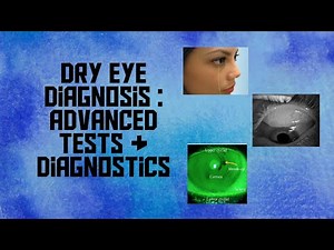 Detect Dry Eye & estimate severity with advanced tests & diagnostic tools