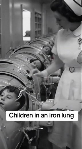 Children in an iron lung before the polio vaccine 1950