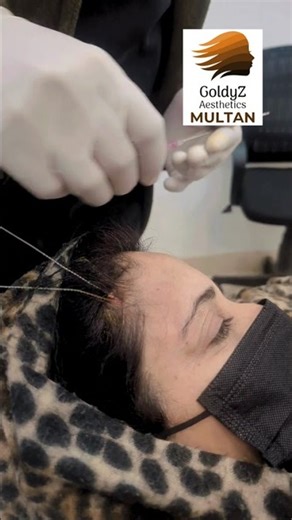 Eyebrow Thread Lift | #Goldyz #Multan