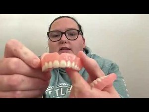 Comparing my temporary dentures | Why I went to affordable dentures