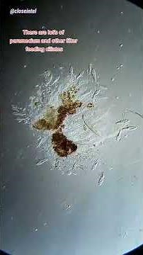 Rubbing Alcohol vs Germs Under Microscope #science #microbiology #microscope