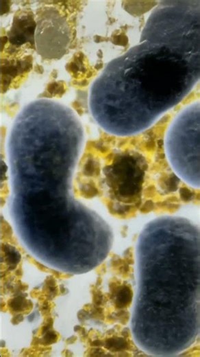 "Microscopic Life Under the Fingernail: Crawling Bacteria Revealed!"