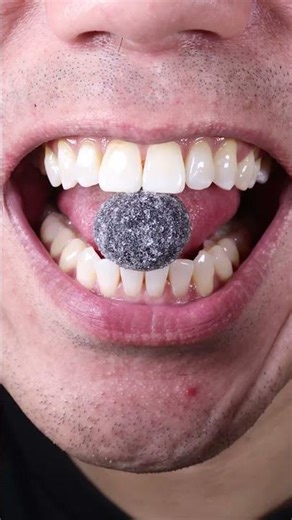 Can You Handle the Satisfying ASMR of Black Currant Pastilles? #asmr #doctortristanpeh #asmrsounds