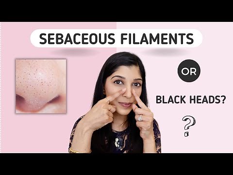Black Dots On The Nose? How To Treat Sebaceous Filaments | Dr. Swati Kannan