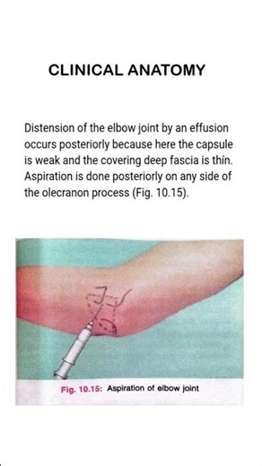 Aspiration of the Elbow Joint#clinicalanatomy