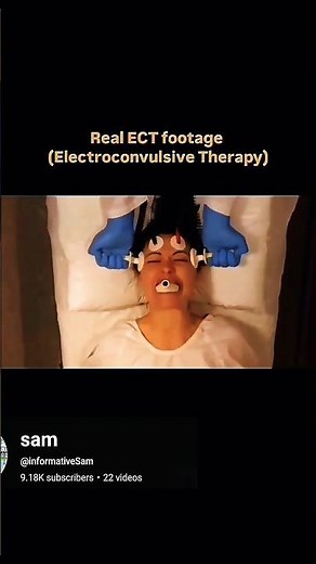 What is ECT and why doctors do it #brainlearning #medicaleducation #biologyscience