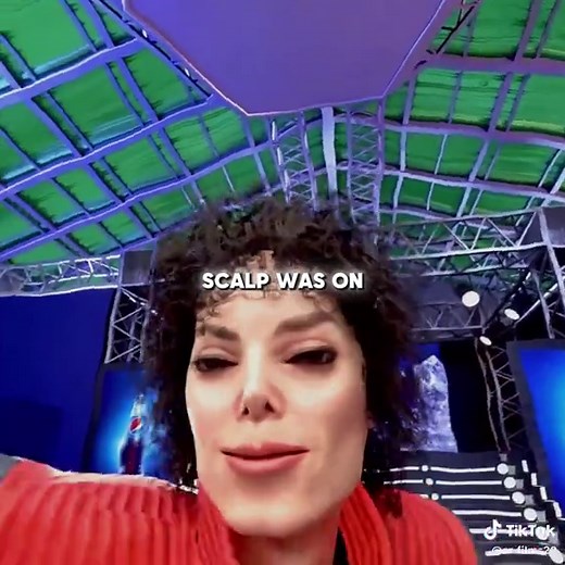 Michael Jackson's Hair Catches Fire: Animated Explanation