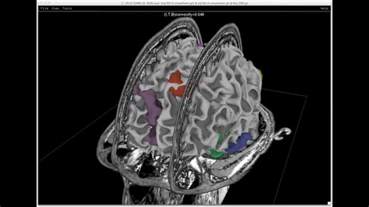 89 Hz Midbrain RIFE Healing Frequency