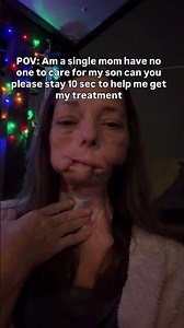 Help me get my cancer treatment. We have raised $0 out of $15000. Link in bio to donate