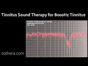 Tinnitus Sound Therapy for 8000Hz Tinnitus