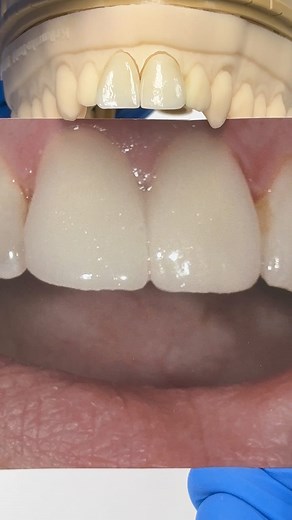 Amber Press Centrals! Case from Dr. Olga Krikunenko in Massachusetts! EnvisionTEC HASSBio Hassambassador Kr #HASSBIO #hassambassador_kr | Luke Kahng | Facebook