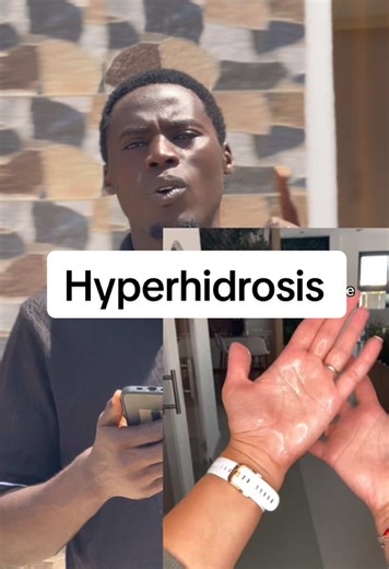 Understanding Hyperhidrosis: Causes and Treatments