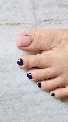 Weird Growing Nails: Unusual Nail Growth Explained