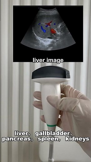 Ultrasound 101 – Probe Types: Phased Array & Convex #DaweiMedical #ultrasound #probe