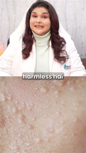 Small Face Bumps That Don’t Respond To Skincare