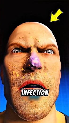 Stop Popping Pimples… You’re Making It Worse 😳