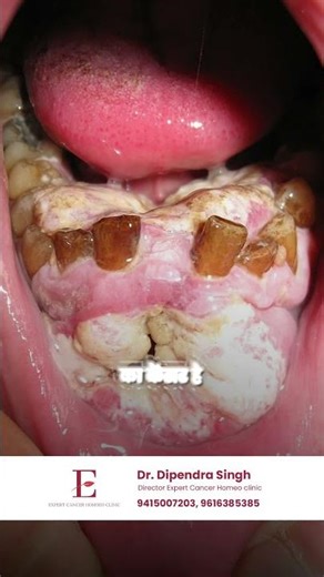 “Cancer Hone Se Pehle Body Deti Hai Ye Signals – Ignore Mat Karein!”