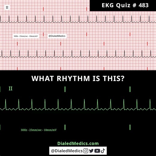 🦋🫀🤔 Can you interpret this EKG rhythm?For more software generated EKG / ECG rhythm interpretation practice visit my profile and website!