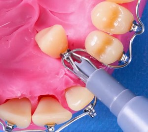 Your Guide to Medical Procedures and Surgeries! | 5-Minute Workouts