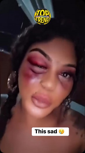 TOP TREND on Instagram: "Watch love ❤️ @trelawny_trending #love #hurts"