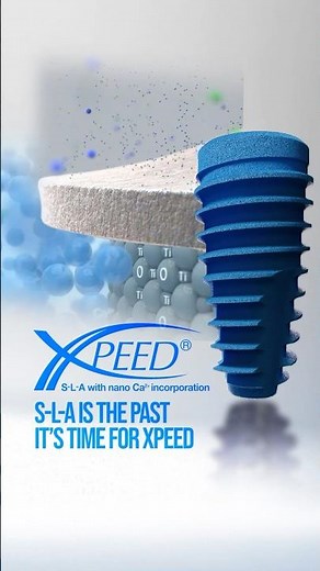 Xpeed vs S-L-A🦷 Which surface treatment?