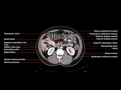 How is a CT scan of the abdomen performed? Procedures in computed tomography imaging