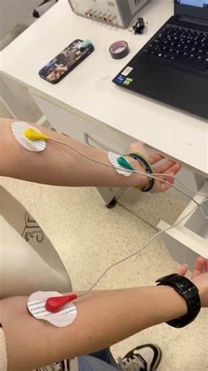ECG-BASED BPM Monitoring System #arduinoproject #diy #ecg #bpm
