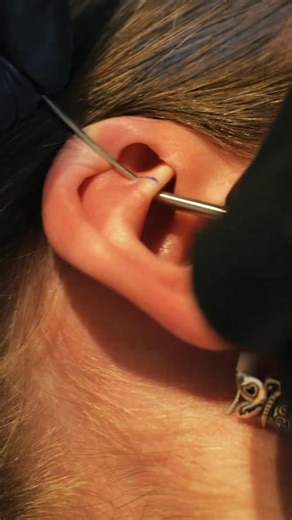 Paradise Montreal ✦ Piercing, Jewelry & Tattoos on Instagram: "Rook piercing ❤️‍🔥 what would you like to see next?? #montreal #mtl #piercingstudio #mtltattoo #montreal"