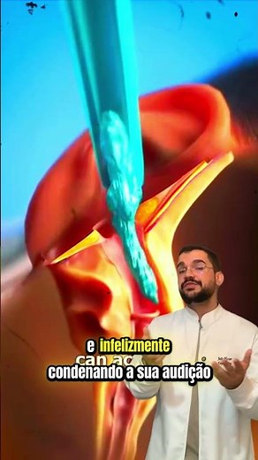 Ear cleaning #viral #tips #doctor