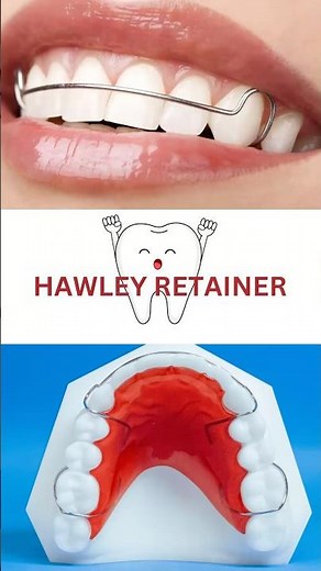 Hawley Retainer