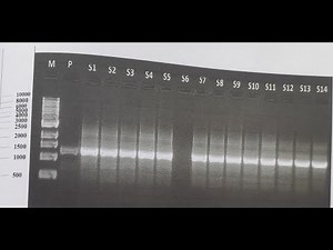 RAPD, AFLP, ISSR marker's data analysis for genetic diversity/variability determination with NTSYSpc