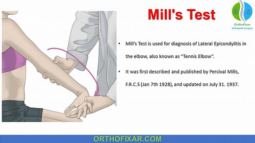 Mill’s Test Explained: Procedure, Positive Sign & Diagnosis Of Tennis Elbow
