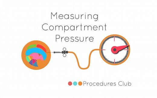 Compartment Pressure Measurement- "Stryker" It! — EM Curious