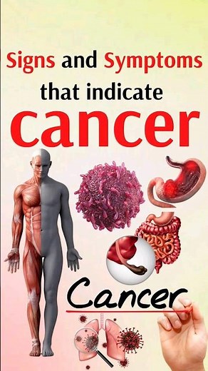 signs and symptoms that indicate cancer