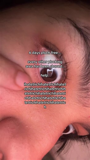 i need to pluck. #trich #trichotillomania #relateable #anxiety #disorder