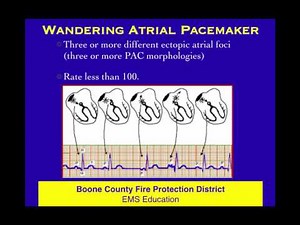ECG 22 Atrial Rhythms