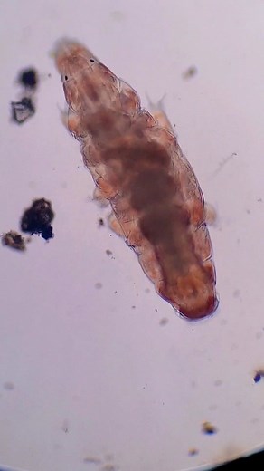 Observamos un Tardígrado con un Microscopio USB #Microscopio #tardigrade #tardigrado #tardigrados #miscroscopio #microorganismos
