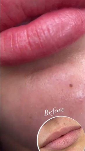 Natural Lip Blush Transformation: Soft & Defined Lips 💋