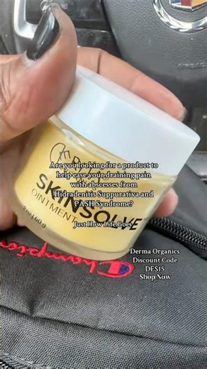 Living with Hidradenitis Suppurativa + PASH Syndrome means even something as small your belly button