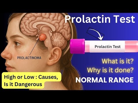What is a Prolactin Test : Procedure, Symptoms, Normal Range, Price in India, Reasons for high level