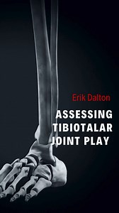 Assessing Tibiotalar A-P Joint Play The junction of the distal tibia and fibula and the talus form the tibiotalar joint (also called the talocrural joint). The trochlea of the talus fits into the space formed by the distal ends of the long bones. The malleoli of the tibia and fibula act to constrain the talus, causing the joint to act as a hinge contributing to the plantarflexion and dorsiflexion motions of the foot. However, the cone shape of the trochlea surface and its oblique rotational axis