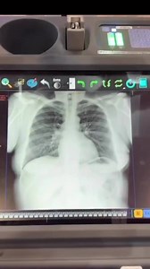 51K views · 1.3K reactions | DDR Dynamic digital radiography The system transmits a serious of pulsed x-rays about 15 times per a second #Ashiry | Radiology Students Of A.M.S | Facebook