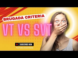 Brugada criteria for VT vs SVT video review