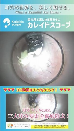 耳のかゆみごとスッキリ！ #耳掃除 #earcleaning #閲覧注意