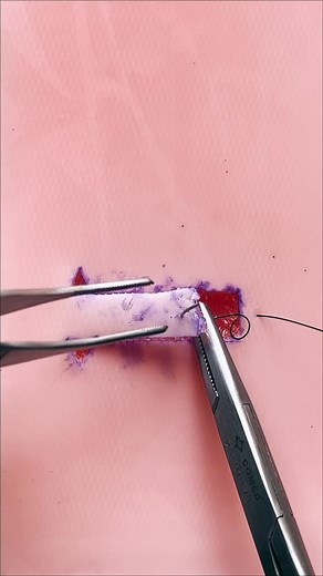 Surgical Technique: Advancement Flap Suture Procedure