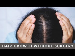 Hair Regrowth Without Surgery? Regenera Activa Explained | Dermatrico | Dr Syed Nazim Hussain