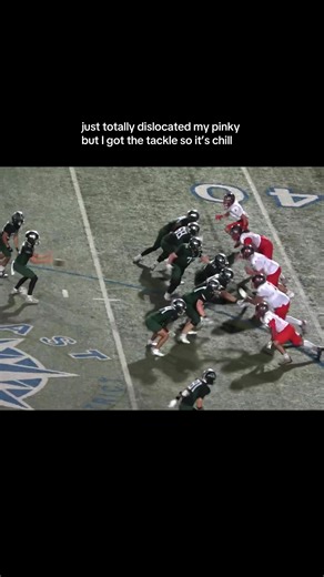 Car Mishap: Recovering from a Dislocated Pinky