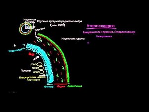 Atherosclerosis, part 1