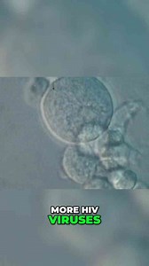 HIV: Retrovirus and the History of Viral Genes Explained